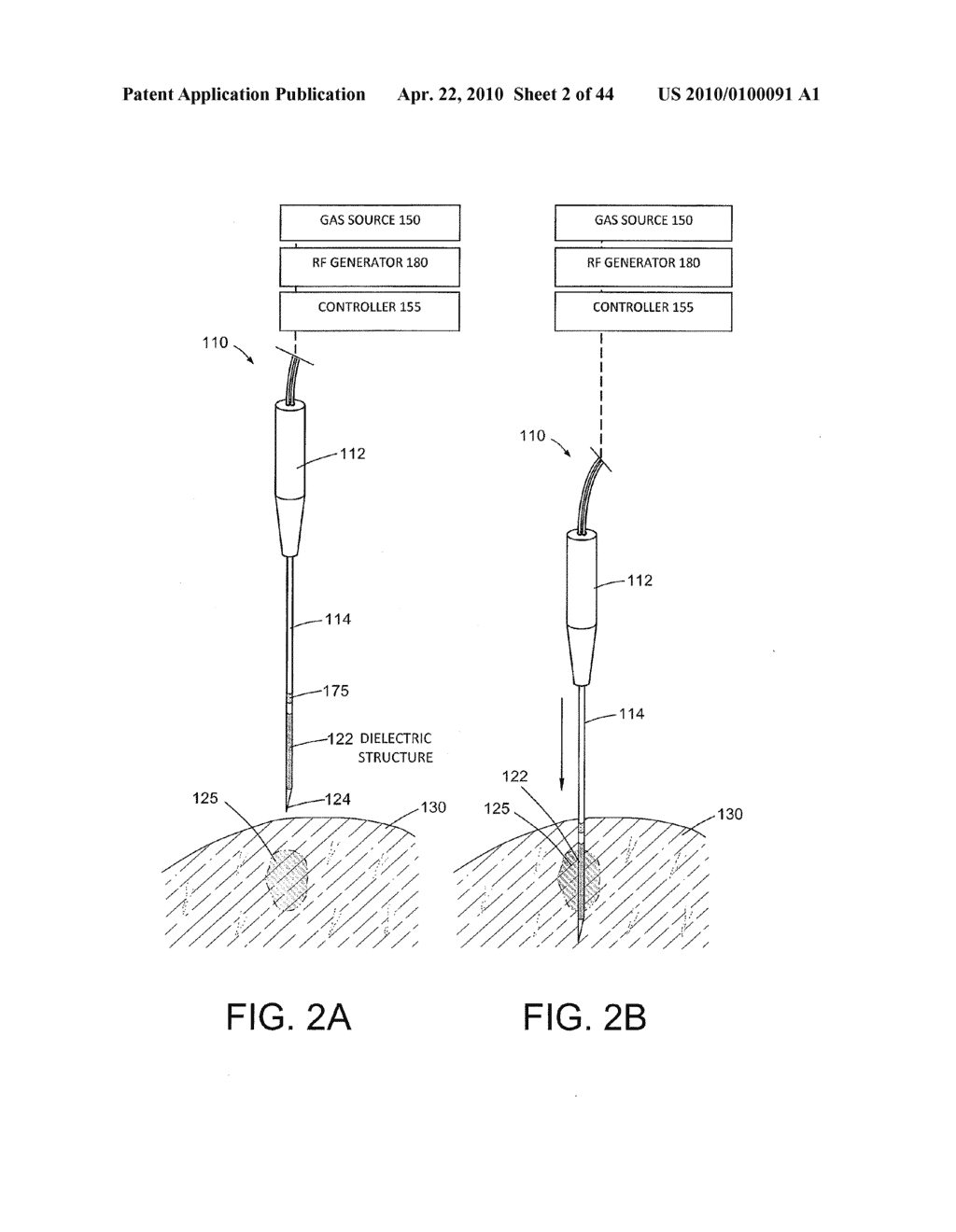 TISSUE ABLATION SYSTEMS - diagram, schematic, and image 03