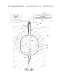 TISSUE ABLATION SYSTEMS diagram and image