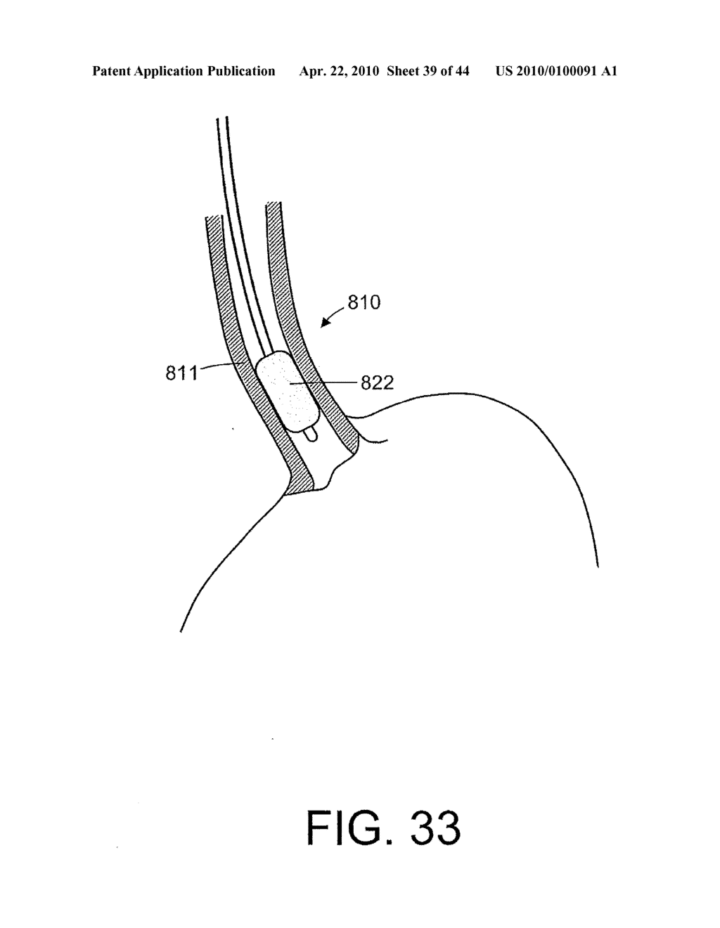 TISSUE ABLATION SYSTEMS - diagram, schematic, and image 40