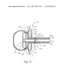 SYSTEMS AND METHODS FOR CEREBROSPINAL FLUID REPAIR diagram and image