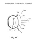 SYSTEMS AND METHODS FOR CEREBROSPINAL FLUID REPAIR diagram and image