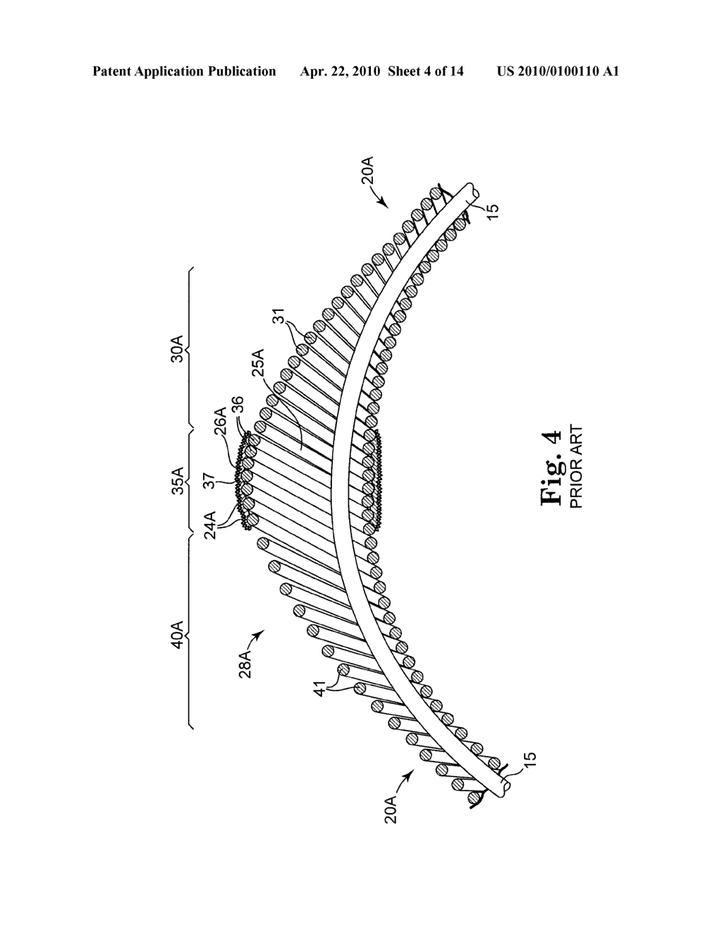 ECCENTRIC ABRADING AND CUTTING HEAD FOR HIGH-SPEED ROTATIONAL ATHERECTOMY DEVICES - diagram, schematic, and image 05