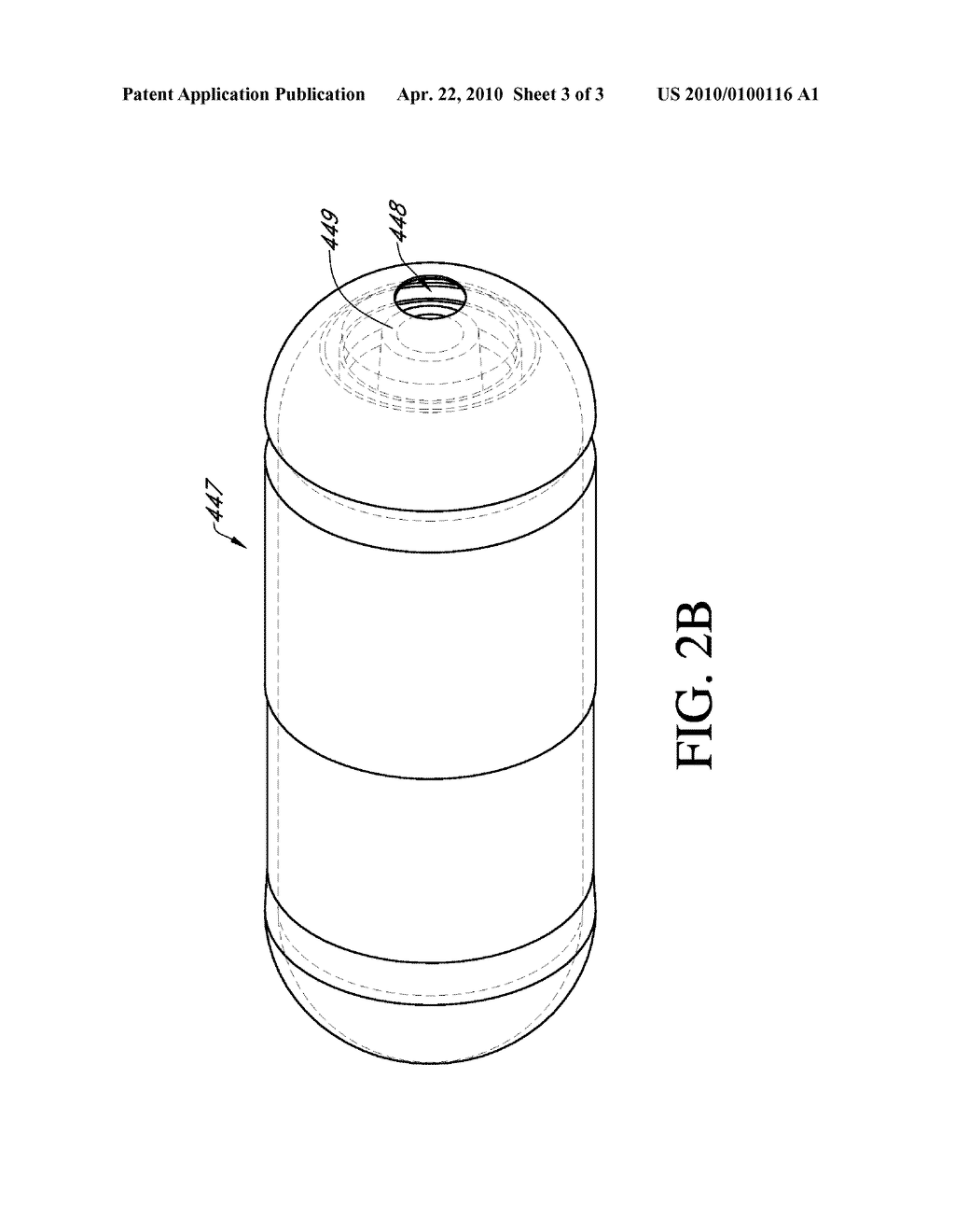 INTRAGASTRIC VOLUME-OCCUPYING DEVICE AND METHOD FOR FABRICATING SAME - diagram, schematic, and image 04