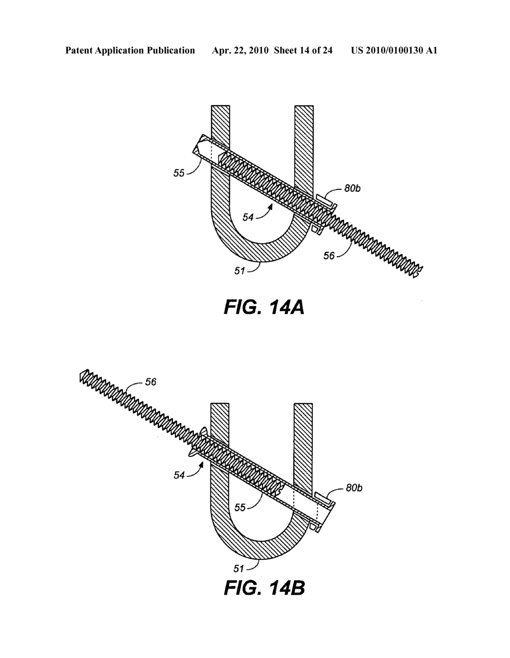 DEVICE AND METHOD FOR CORRECTING A SPINAL DEFORMITY - diagram, schematic, and image 15