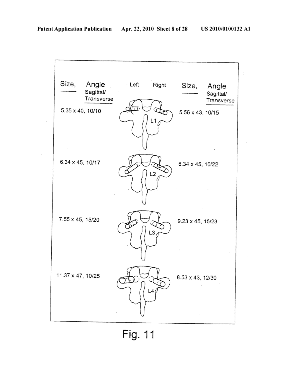 System and methods for improved access to vertebral bodies for kyphoplasty, vertebroplsaty, vertebral body biopsy or screw placement - diagram, schematic, and image 09