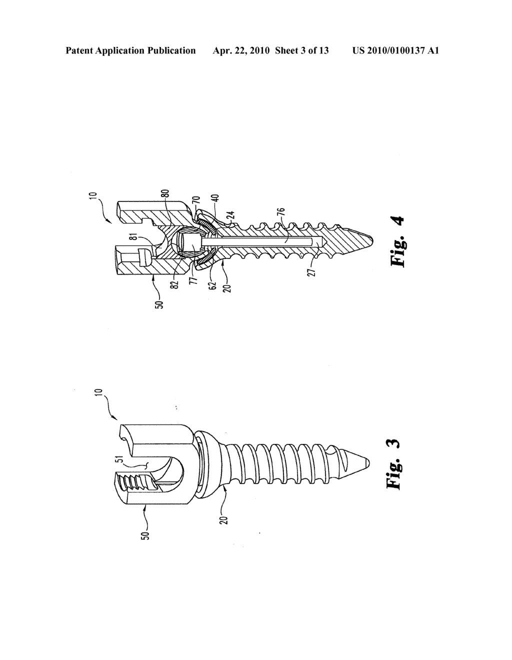 Dynamic Anchor Assembly for Connecting Elements in Spinal Surgical Procedures - diagram, schematic, and image 04