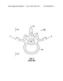 INSERTION TOOL FOR A VERTEBRAL DEFECT DEVICE diagram and image