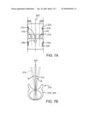 Methods and Apparatus For Intervertebral Disc Prosthesis Insertion diagram and image