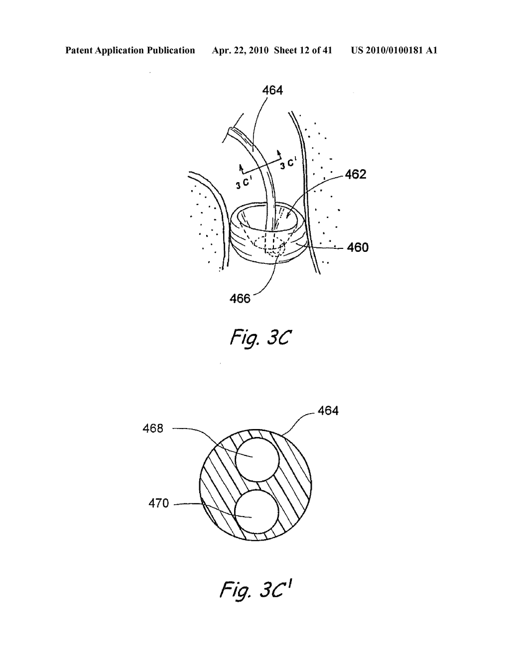 DEVICES, SYSTEMS AND METHODS FOR DIAGNOSING AND TREATING SINUSITUS ANDOTHER DISORDERS OF THE EARS, NOSE AND/OR THROAT - diagram, schematic, and image 13