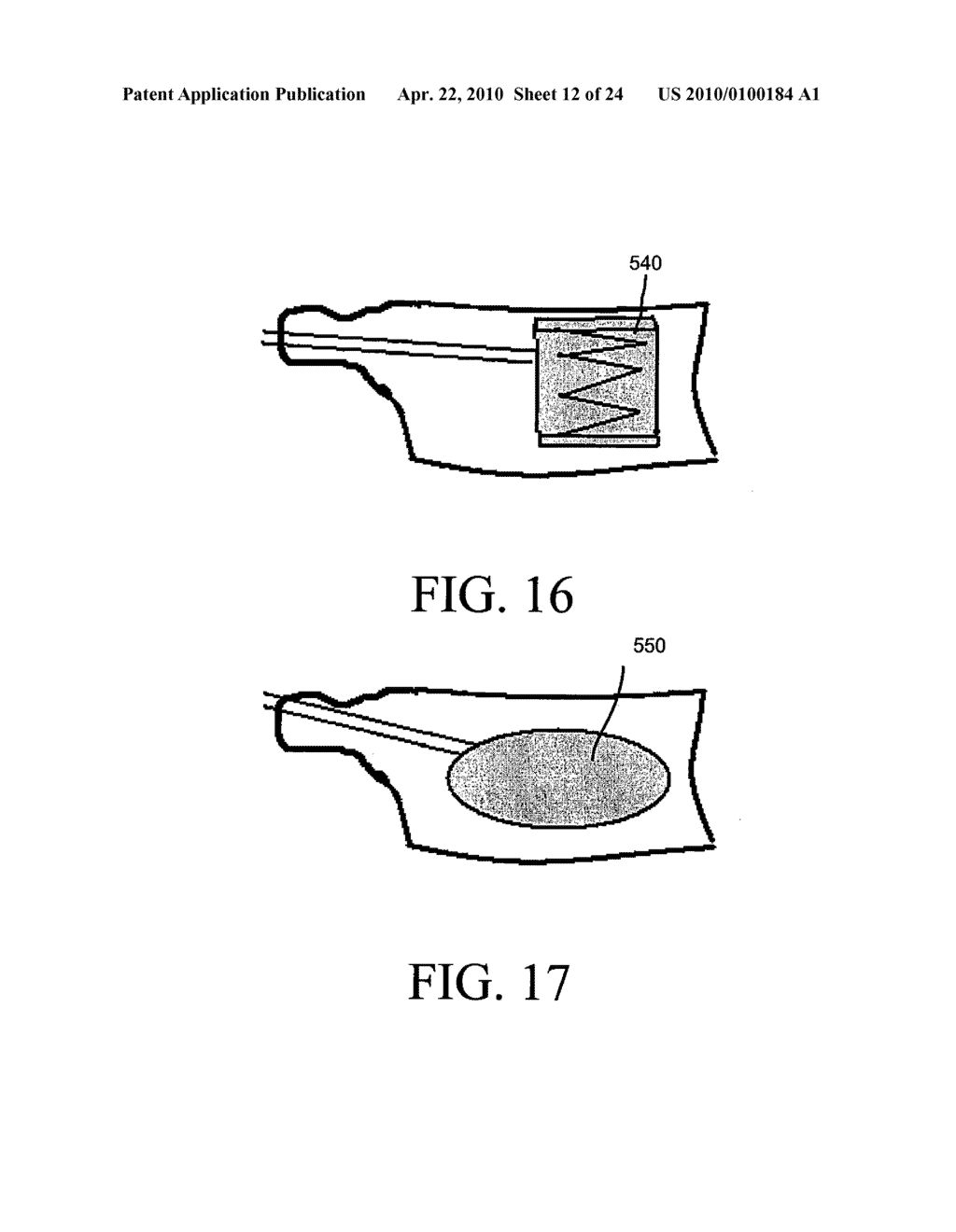 METHOD AND STRUCTURE FOR STABILIZING A VERTEBRAL BODY - diagram, schematic, and image 13