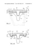 Tibial Tray Having a Reinforcing Member diagram and image