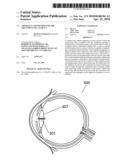 Apparatus and Method For The Treatment of Cataract diagram and image