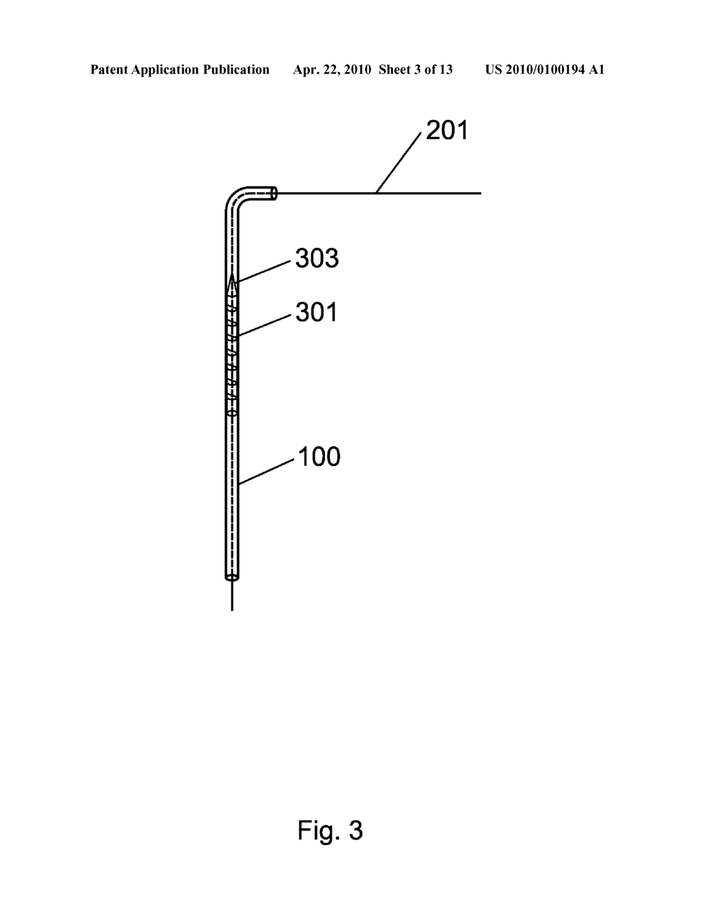 Apparatus and Method For The Treatment of Cataract - diagram, schematic, and image 04