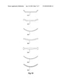 Indicator Post diagram and image