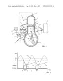 Method and Device for Priming a Fuel Metering Device diagram and image