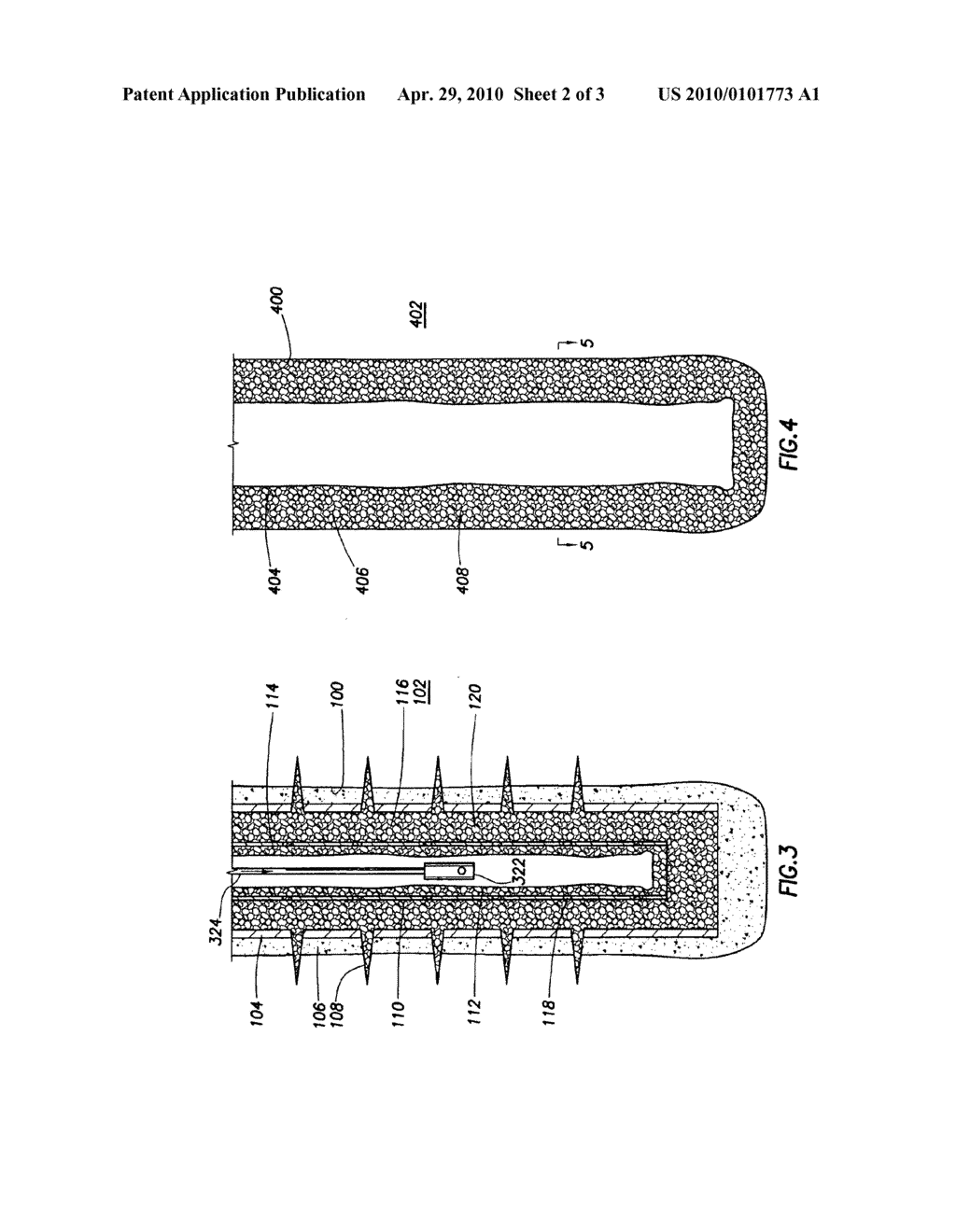 Methods of Cleaning Sand Control Screens and Gravel Packs - diagram, schematic, and image 03