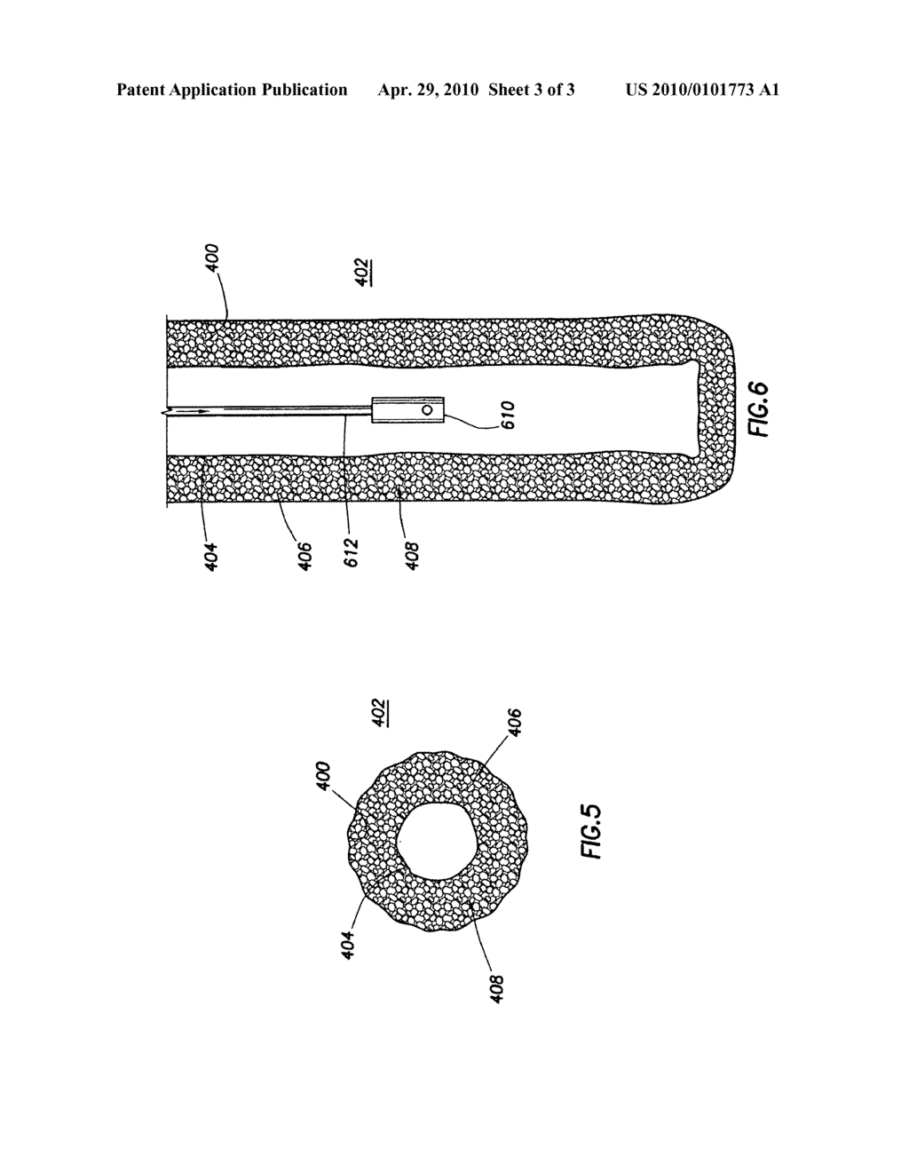 Methods of Cleaning Sand Control Screens and Gravel Packs - diagram, schematic, and image 04