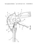 EXTENDIBLE REACHER diagram and image