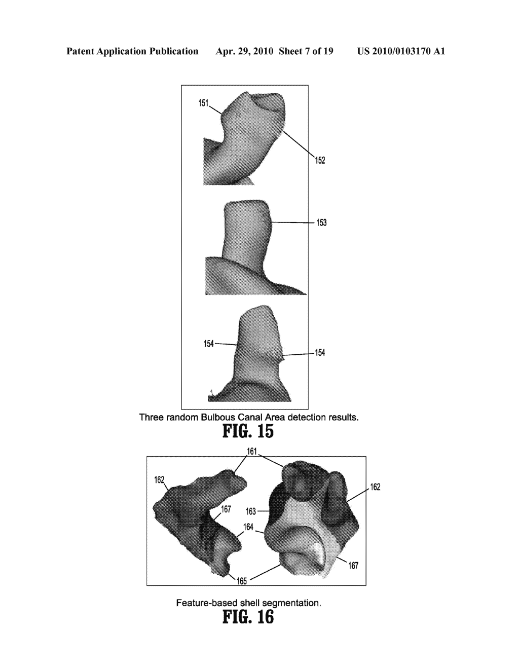 SYSTEM AND METHOD FOR AUTOMATIC DETECTION OF ANATOMICAL FEATURES ON 3D EAR IMPRESSIONS - diagram, schematic, and image 08