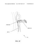 EARPIECE BASED BINAURAL SOUND CAPTURING AND PLAYBACK diagram and image