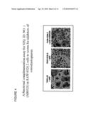 POLYNUCLEOTIDES AND POLYPEPTIDE SEQUENCES INVOLVED IN THE PROCESS OF BONE REMODELING diagram and image