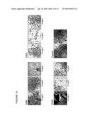 POLYNUCLEOTIDES AND POLYPEPTIDE SEQUENCES INVOLVED IN THE PROCESS OF BONE REMODELING diagram and image