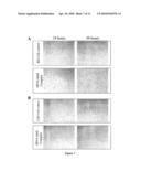 METHOD AND COMPOSITION FOR TREATMENT OF NEOPLASMS diagram and image