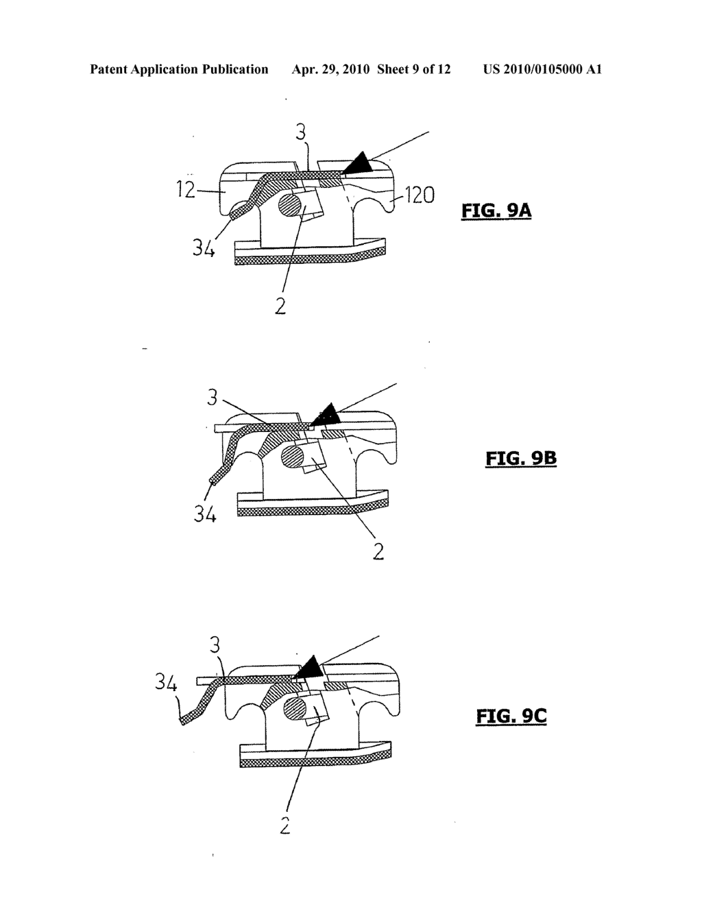 ORTHODONTIC BRACKET - diagram, schematic, and image 10