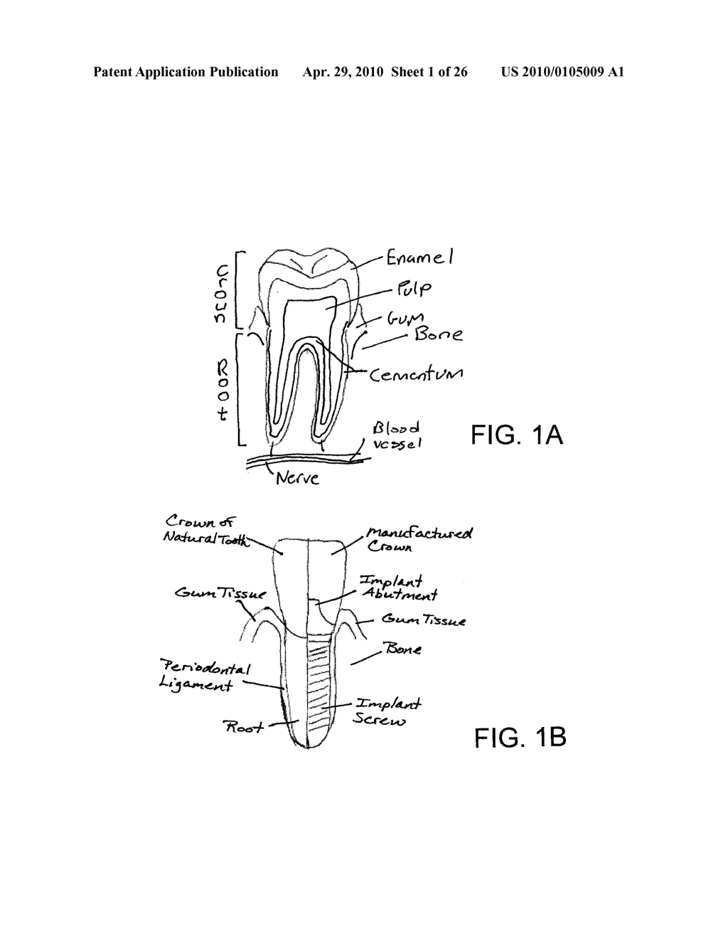 System, Method And Apparatus For Tooth Implants - diagram, schematic, and image 02