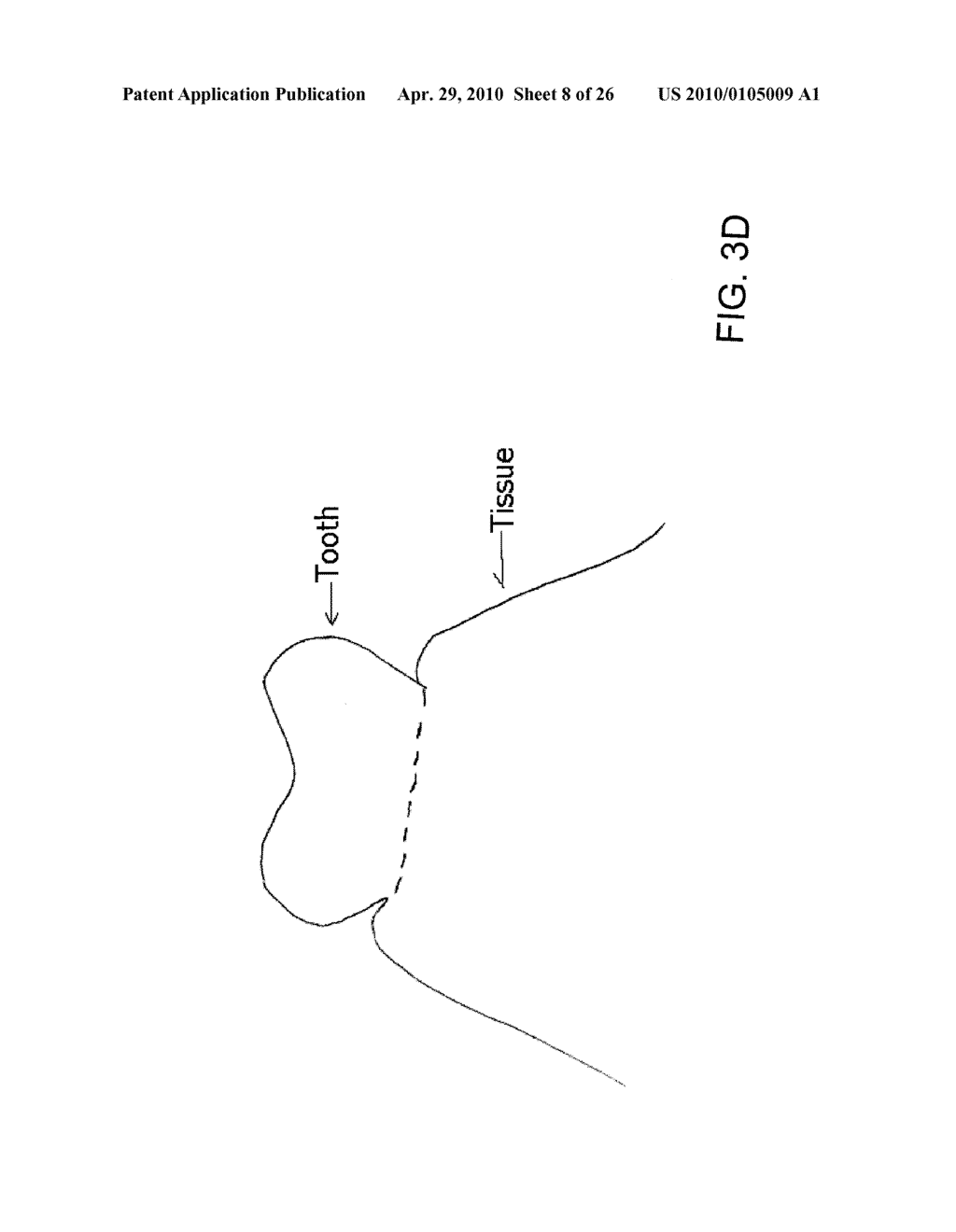 System, Method And Apparatus For Tooth Implants - diagram, schematic, and image 09