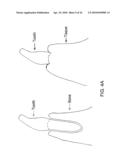 System, Method And Apparatus For Tooth Implants diagram and image