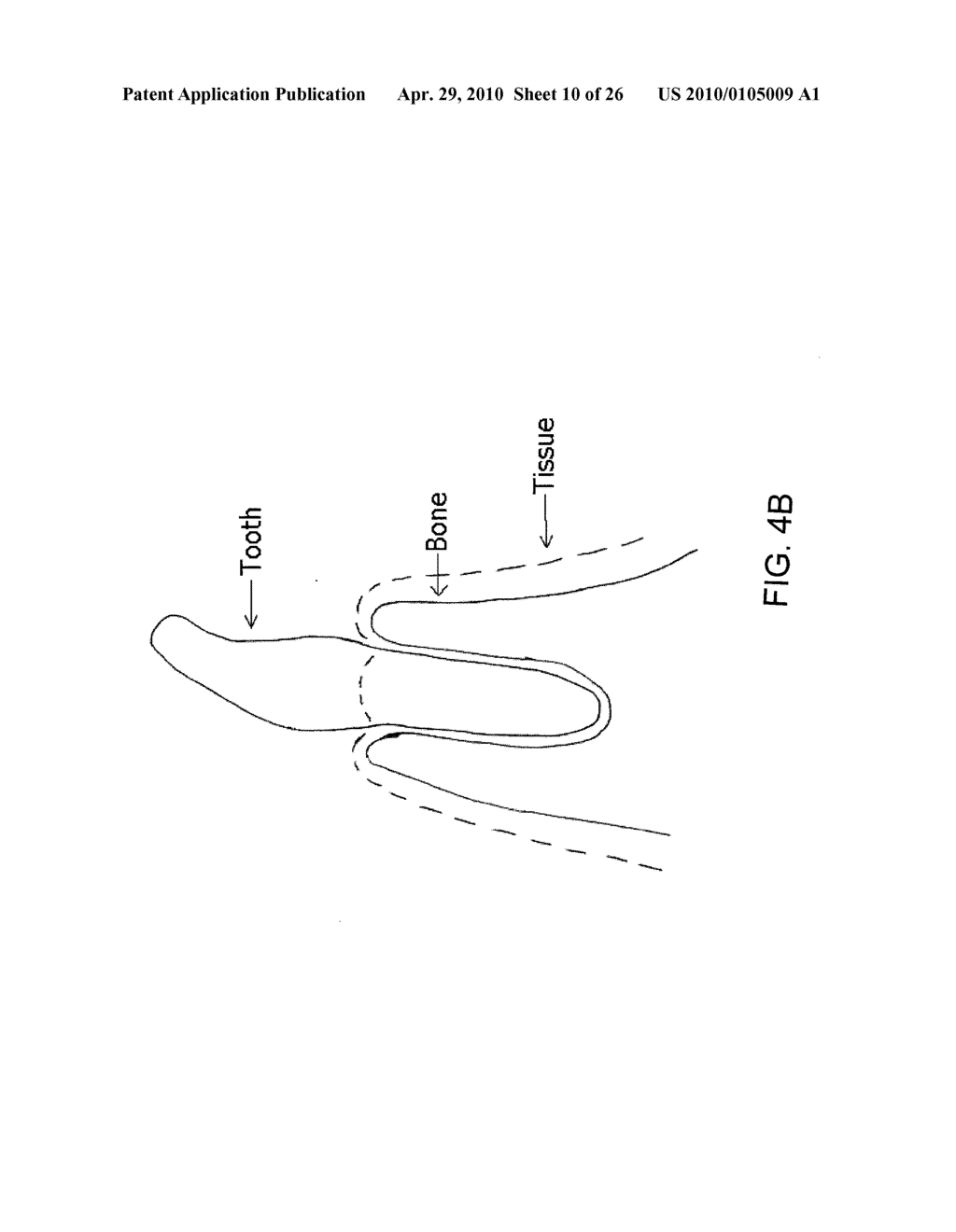 System, Method And Apparatus For Tooth Implants - diagram, schematic, and image 11