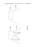 System, Method And Apparatus For Tooth Implants diagram and image