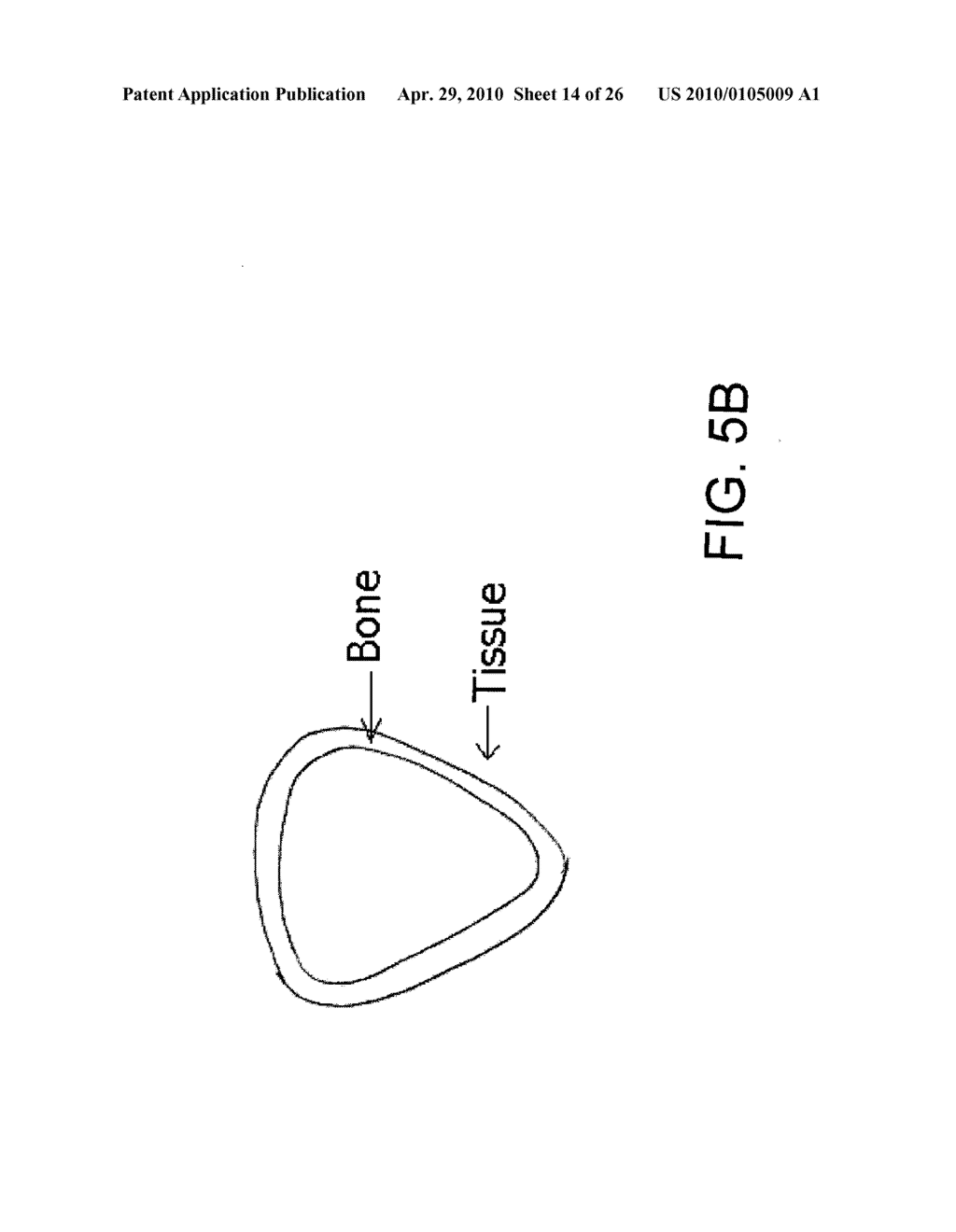 System, Method And Apparatus For Tooth Implants - diagram, schematic, and image 15