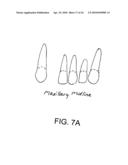 System, Method And Apparatus For Tooth Implants diagram and image