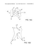 System, Method And Apparatus For Tooth Implants diagram and image