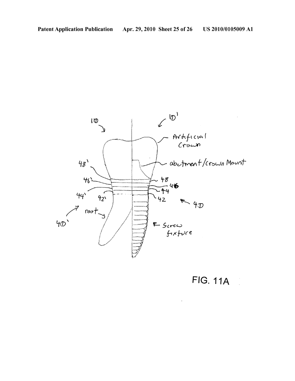 System, Method And Apparatus For Tooth Implants - diagram, schematic, and image 26