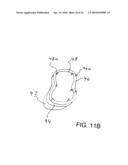 System, Method And Apparatus For Tooth Implants diagram and image