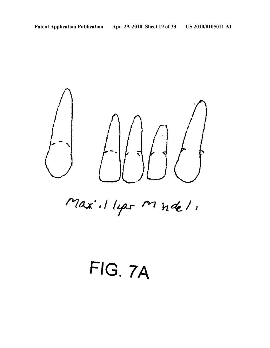 System, Method And Apparatus For Tooth Implant Planning And Tooth Implant Kits - diagram, schematic, and image 20