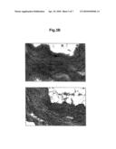 METHODS OF DIAGNOSING CARDIOVASCULAR DISEASE diagram and image