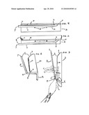 Rabbit and poultry cervical vertebral dislocation apparatus diagram and image