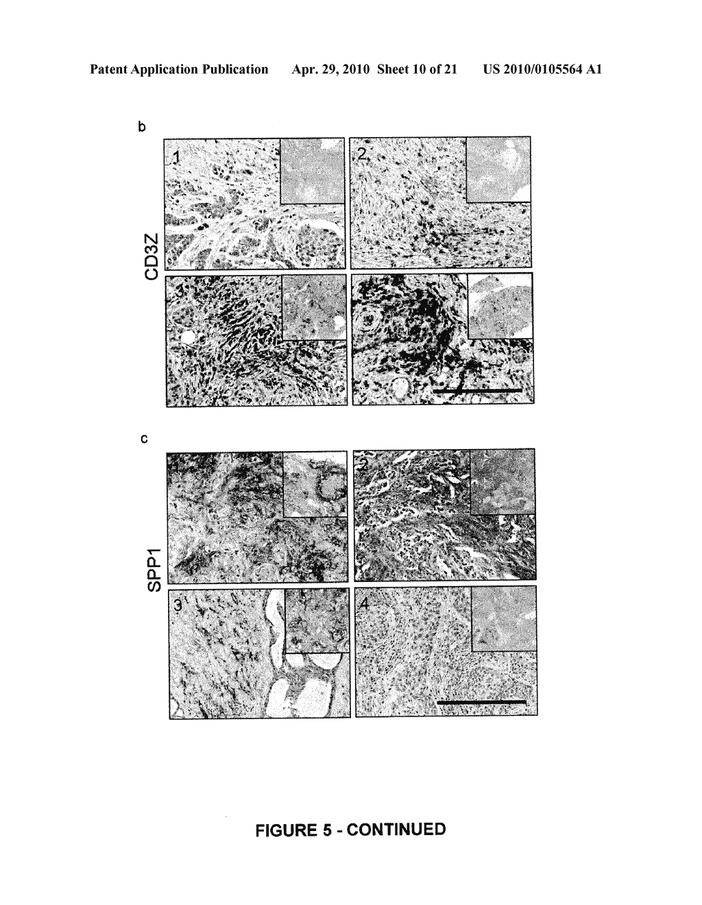 Stroma Derived Predictor of Breast Cancer - diagram, schematic, and image 11