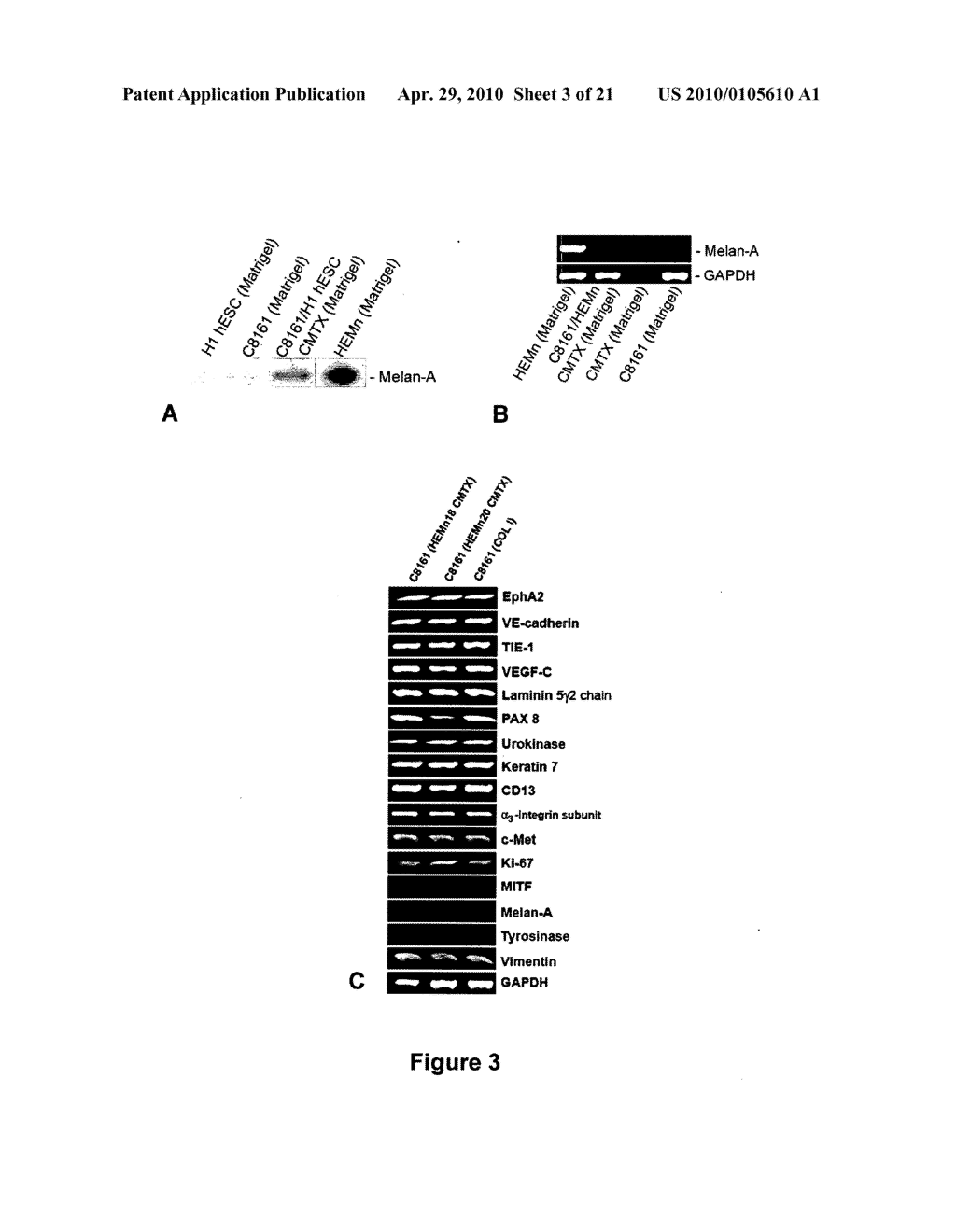 Methods of Inhibiting Tumor Cell Aggressiveness Using the Microenvironment of Human Embryonic Stem Cells - diagram, schematic, and image 04