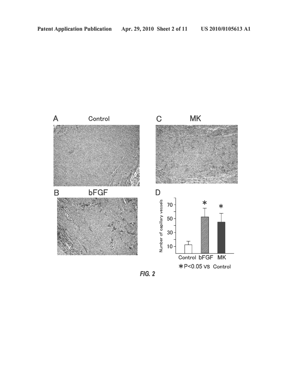 THERAPEUTIC AGENT FOR OCCLUSIVE PERIPHERAL VASCULAR DISEASE, AND USE THEREOF - diagram, schematic, and image 03