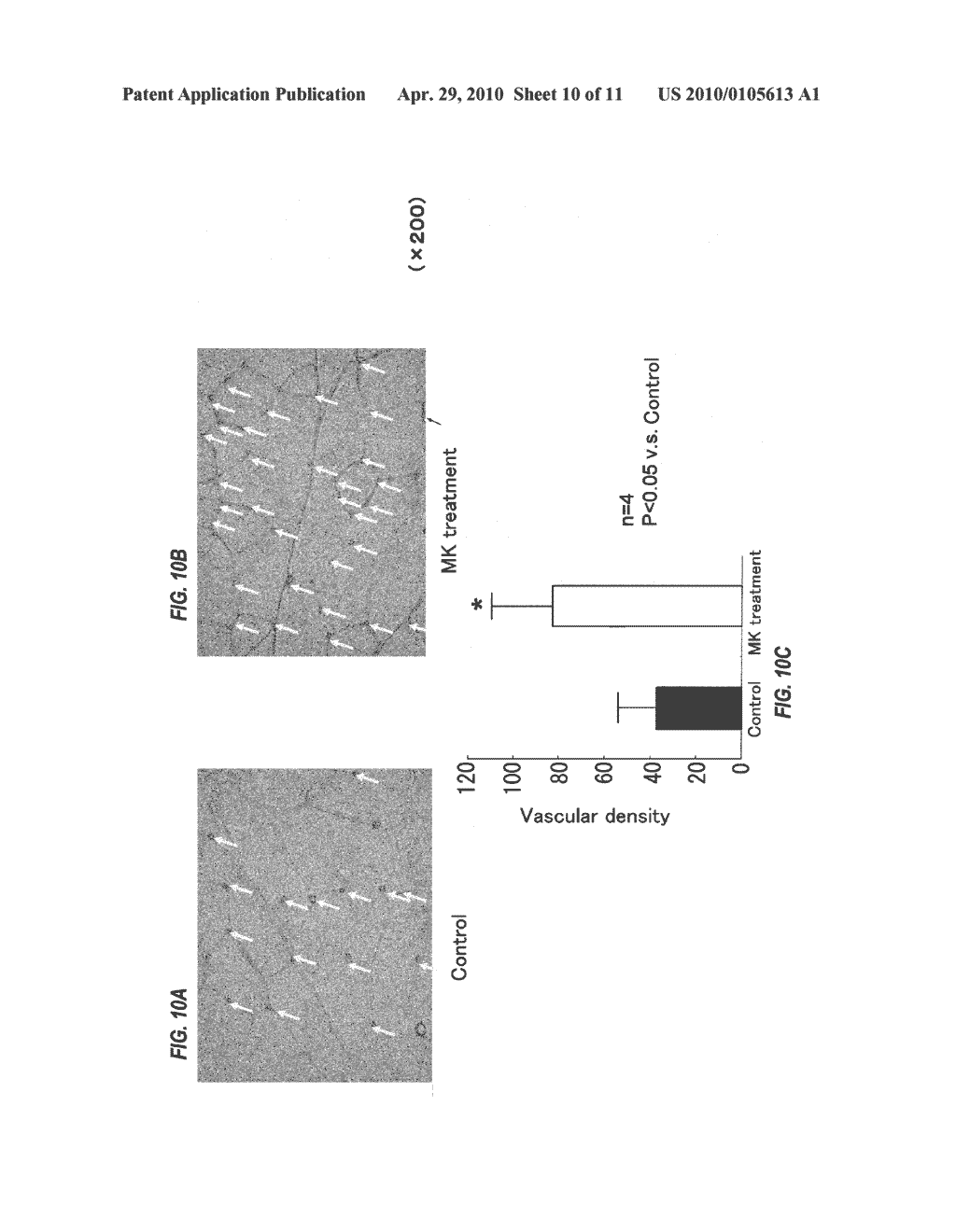 THERAPEUTIC AGENT FOR OCCLUSIVE PERIPHERAL VASCULAR DISEASE, AND USE THEREOF - diagram, schematic, and image 11