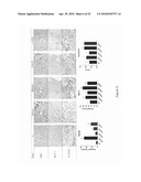 TREATMENT AND INHIBITION OF DISEASE CONDITIONS USING FLEXIBLE HETEROAROTINOIDS diagram and image