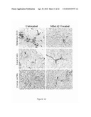 TREATMENT AND INHIBITION OF DISEASE CONDITIONS USING FLEXIBLE HETEROAROTINOIDS diagram and image