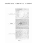 TREATMENT AND INHIBITION OF DISEASE CONDITIONS USING FLEXIBLE HETEROAROTINOIDS diagram and image