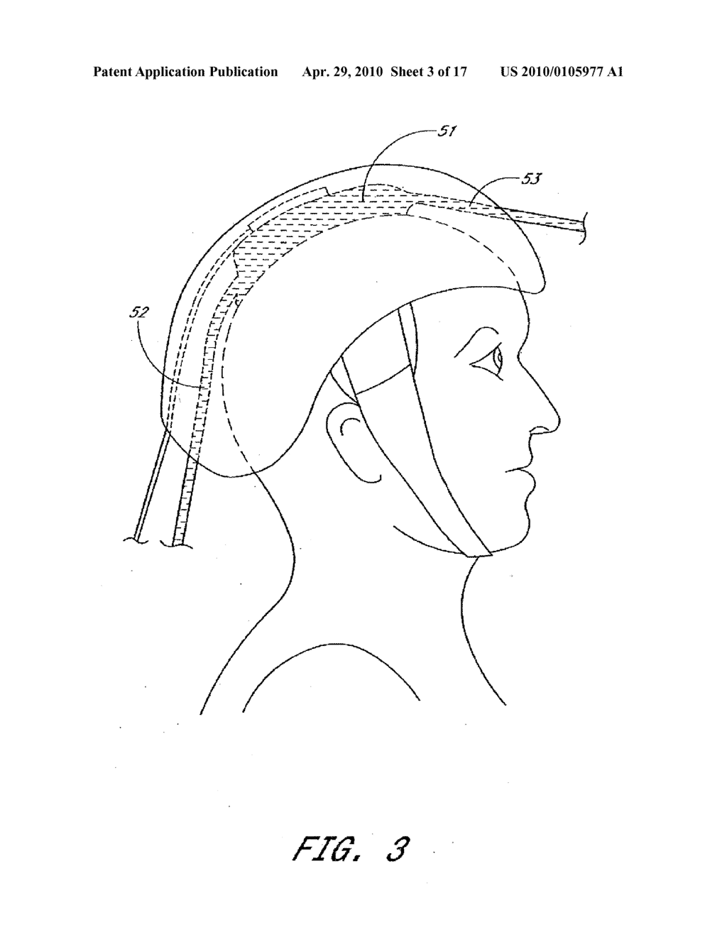METHOD FOR PROVIDING PHOTOTHERAPY TO THE BRAIN - diagram, schematic, and image 04