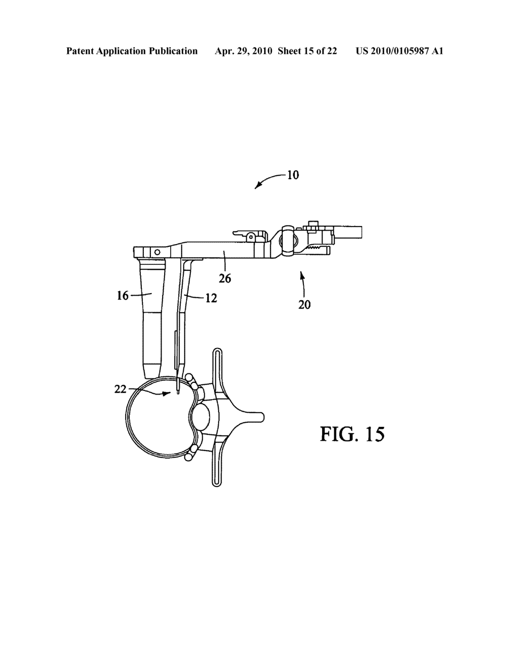 SURGICAL ACCESS SYSTEM AND RELATED METHOD - diagram, schematic, and image 16